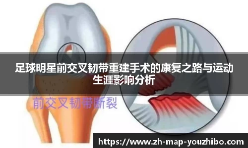 足球明星前交叉韧带重建手术的康复之路与运动生涯影响分析